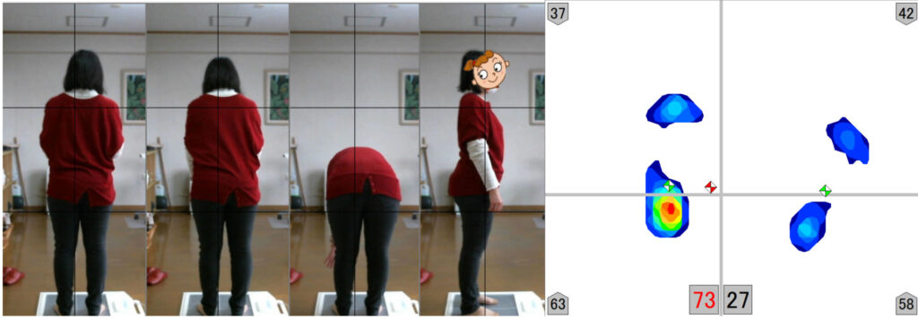 腱鞘炎を整骨院で治療する