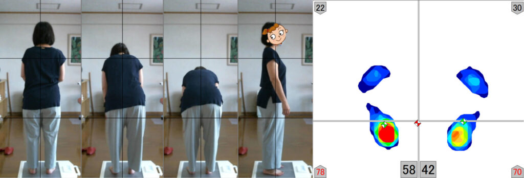 腱鞘炎を整骨院で治す方法